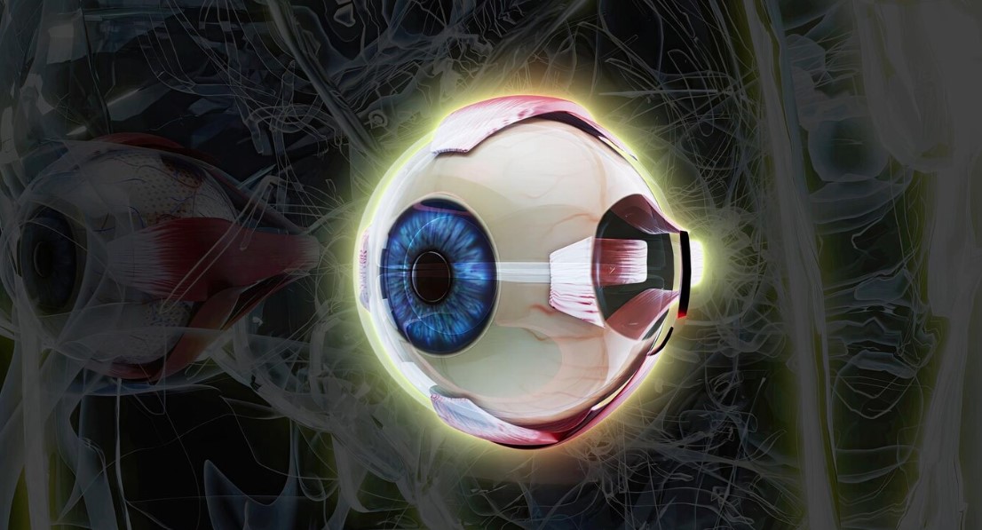 Orbital infarction syndrome after transcanalicular dacryocystorhinostomy with diode laser